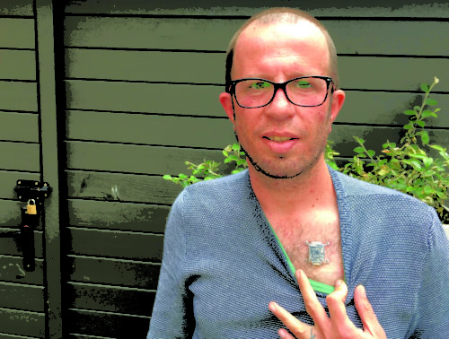 Liviu Babitz implante en el torax que incluye brújula y conexión Bluetooth * ART LAB