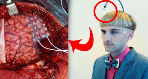 Neil Harbisson tiene una antena en su cráneo * ART LAB